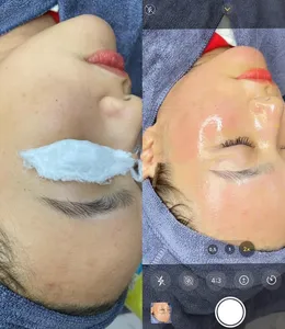 KẾT QUẢ CĂNG BÓNG DA