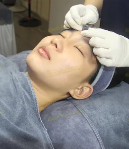 Nặn Mụn Cơ Bản