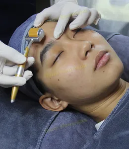 Phi Kim Trị Sẹo Rỗ