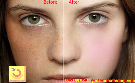 Công dụng của yến sào với phụ nữ làm đẹp Công dụng của yến sào với phụ nữ làm đẹp