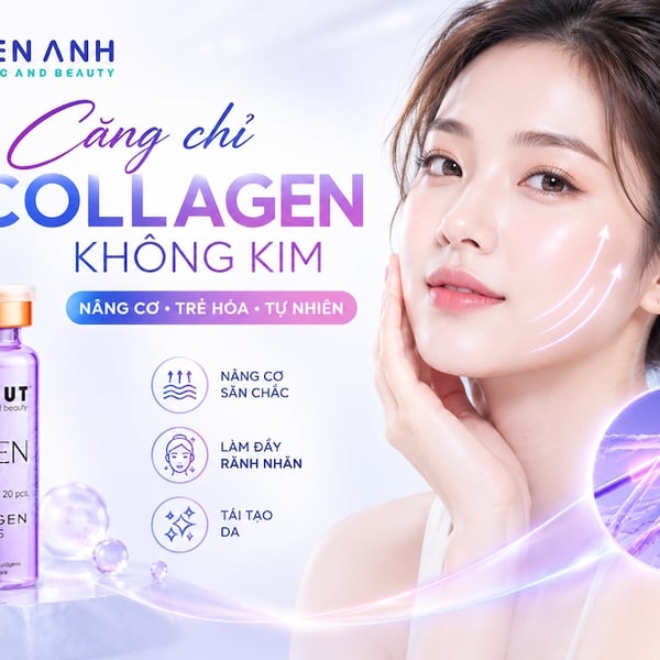 CĂNG CHỈ COLLAGEN KHÔNG KIM