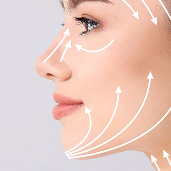 CĂNG CHỈ COLLAGEN KHÔNG KIM