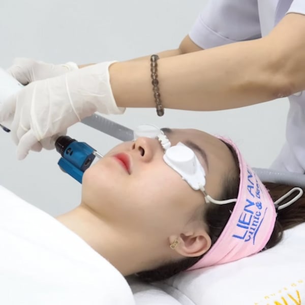 Trẻ hoá da mặt bằng công nghệ cao Harmony XL Pro