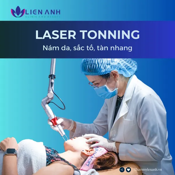 Trẻ hóa + trị nám - Laser Toning