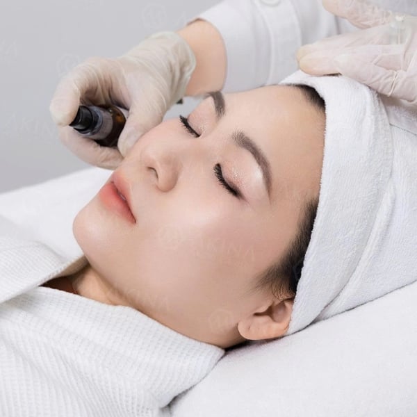 Triệt lông mặt
