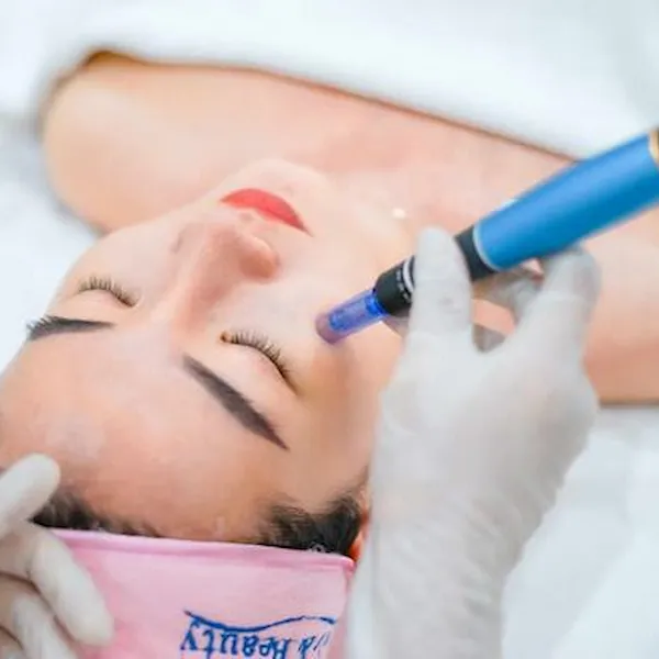 Phi kim - Thảo dược