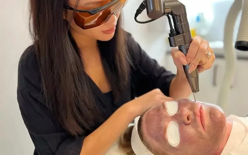 Trẻ hoá toning là gì? Chăm sóc da sau laser toning