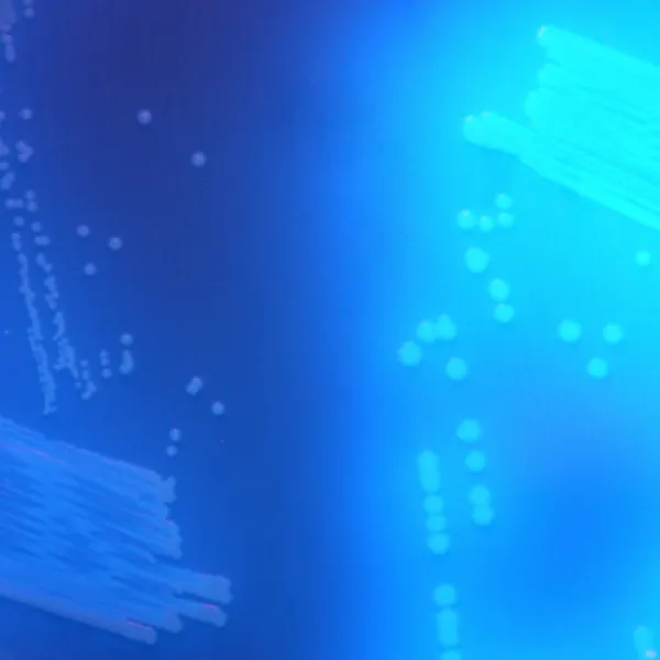 CHROMagar™ C. difficile