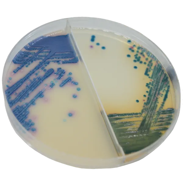 CHROMagar™ Mastitis