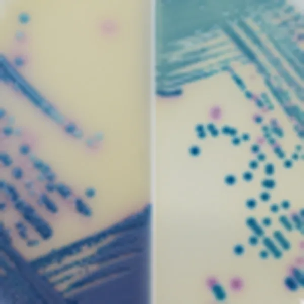 CHROMagar™ Mastitis