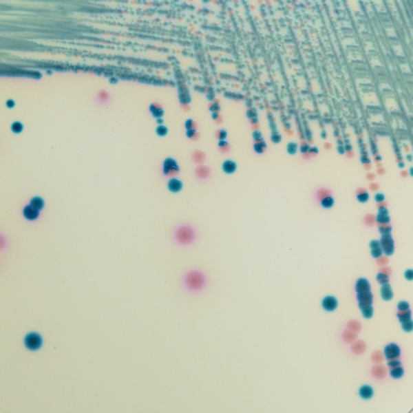 CHROMagar™ mSuperCARBA™