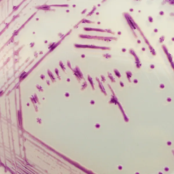 CHROMagar™ Pasteurella