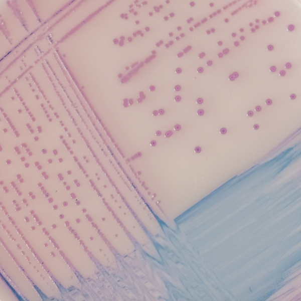 CHROMagar™ Salmonella