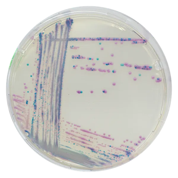 CHROMagar™ Streptococcus
