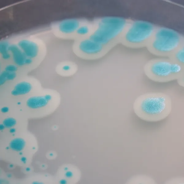 CHROMagar™ B. cereus