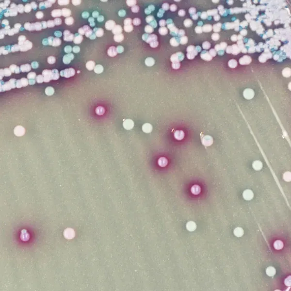 CHROMagar™ Malassezia