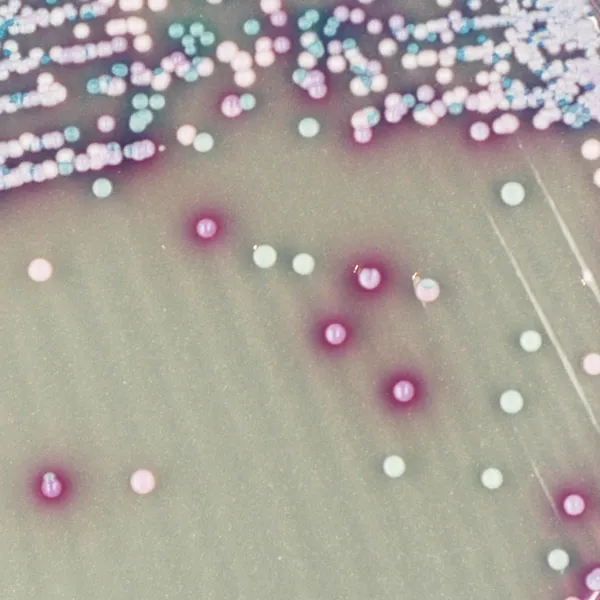 CHROMagar™ Malassezia