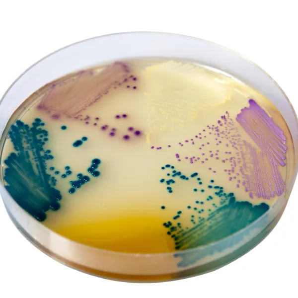 CHROMagar™ Orientation