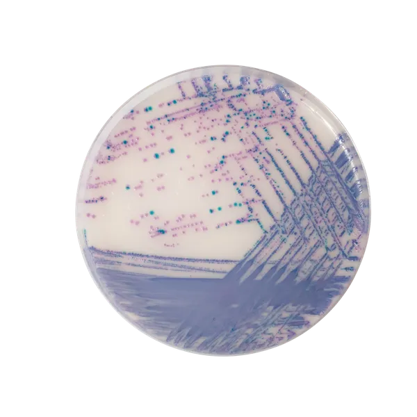 CHROMagar™ Salmonella Plus