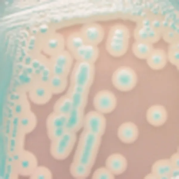 CHROMagar™ B. cereus