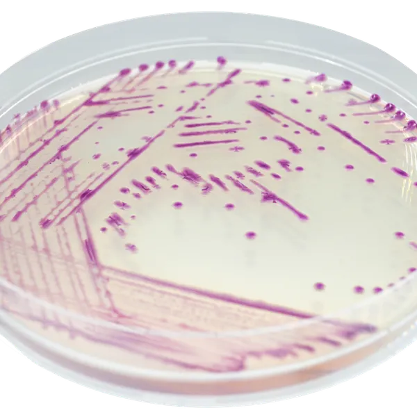 CHROMagar™ Pasteurella