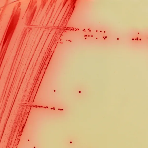 CHROMagar™ Mycoplasma