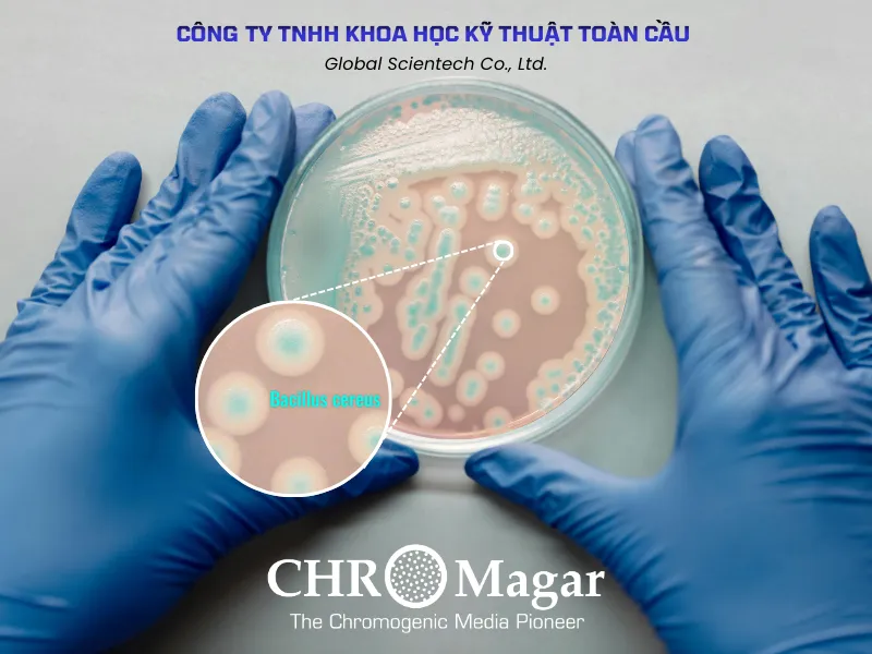 Tối Ưu An Toàn Sinh Học Ngành Sữa: Vai Trò Của CHROMagar B. cereus Trong Nhận Diện Sớm Bacillus cereus