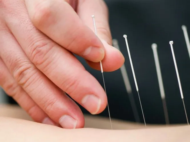 Bác sĩ Y Học Cổ Truyền
