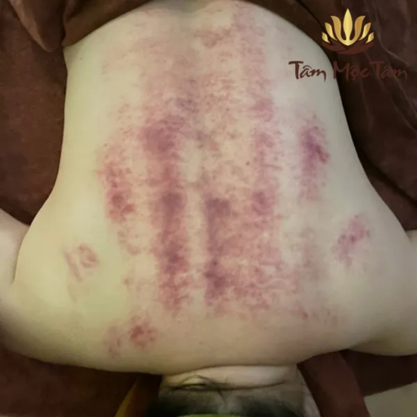 Dưỡng Sinh Bài Độc Lưng (Vai - Gan - Thận) I 60P