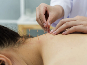 Khai Giảng Lớp Học Châm Cứu tại Hải Phòng