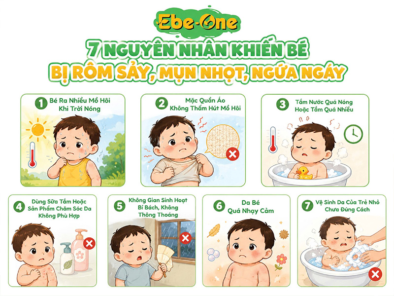 7 Nguyên Nhân Khiến Bé Bị Rôm Sảy, Mụn Nhọt Ngứa Ngáy 7 Nguyên Nhân Khiến Bé Bị Rôm Sảy, Mụn Nhọt Ngứa Ngáy