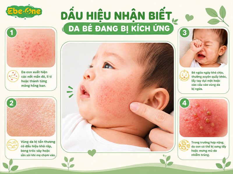 Dấu hiệu nhận biết da bé đang bị kích ứng Dấu hiệu nhận biết da bé đang bị kích ứng