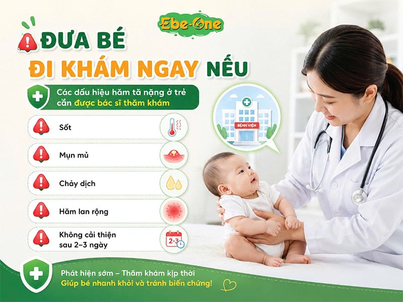 Khi nào cần đưa bé đi khám hăm tã? Các Dấu Hiệu Hăm Tã Nặng Ở Trẻ Cần Được Bác Sĩ Thăm Khám