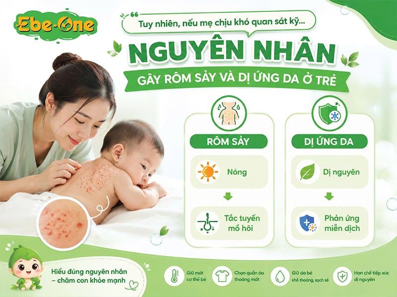 Nguyên Nhân Gây Rôm Sảy Và Dị Ứng Da Ở Trẻ Nguyên Nhân Gây Rôm Sảy Và Dị Ứng Da Ở Trẻ