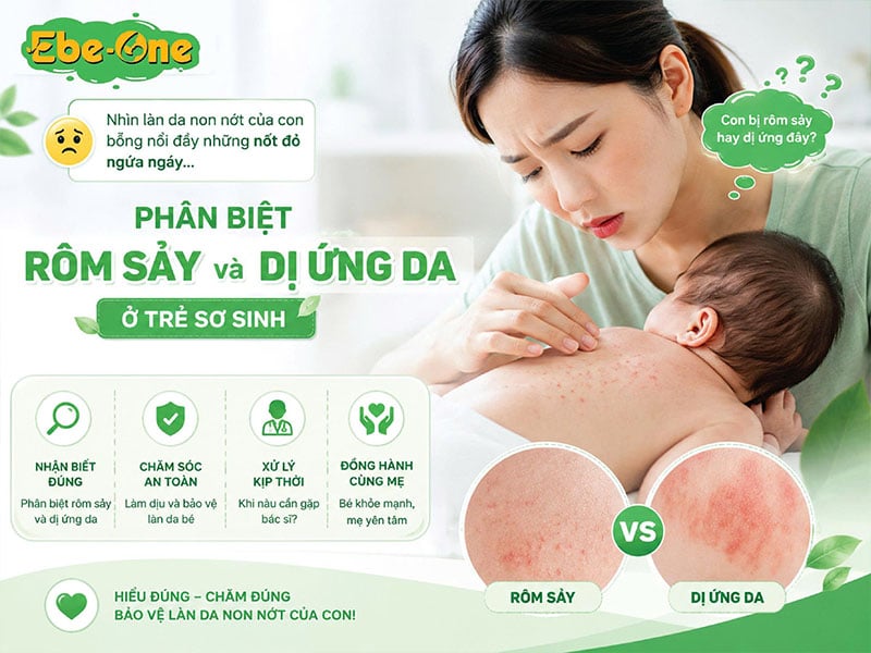 Phân Biệt Rôm Sảy Và Dị Ứng Da Ở Trẻ Sơ Sinh Phân Biệt Rôm Sảy Và Dị Ứng Da Ở Trẻ Sơ Sinh
