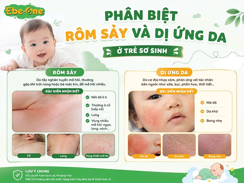 Nguyên Nhân Gây Rôm Sảy Và Dị Ứng Da Ở Trẻ Nguyên Nhân Gây Rôm Sảy Và Dị Ứng Da Ở Trẻ