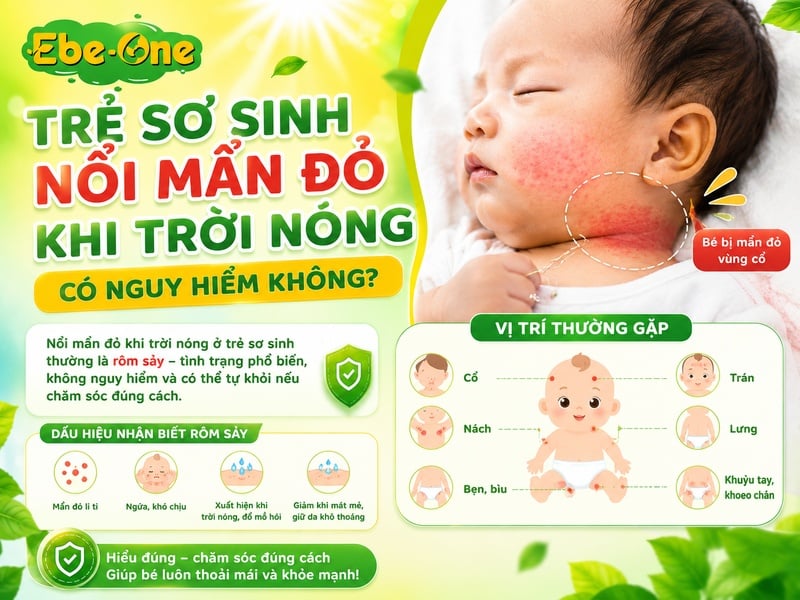 Trẻ Sơ Sinh Nổi Mẩn Đỏ Có Nguyên Hiểm Không Trẻ Sơ Sinh Nổi Mẩn Đỏ Có Nguyên Hiểm Không