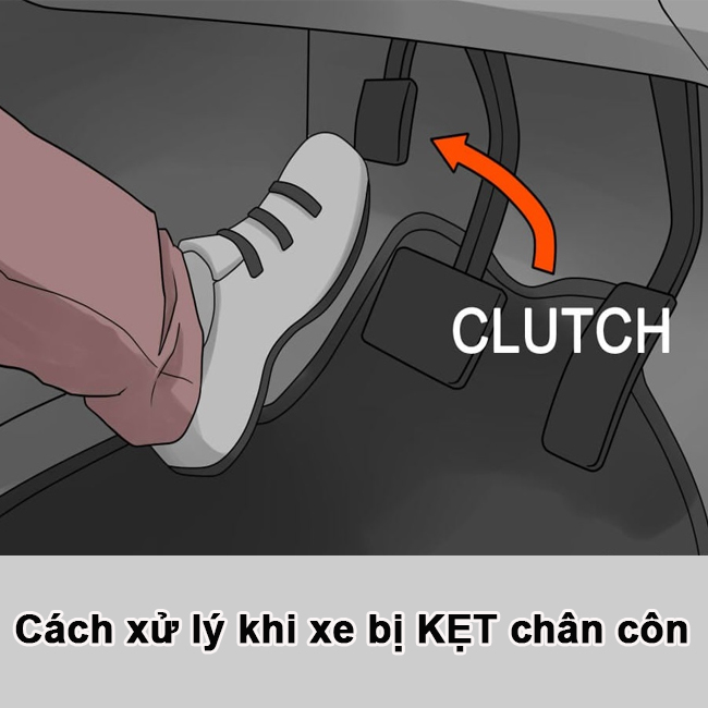 xử lý khi xe bị kẹt chân côn