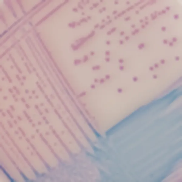 CHROMagar™ Salmonella