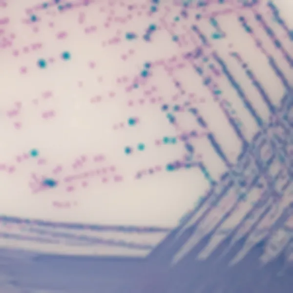 CHROMagar™ Salmonella Plus