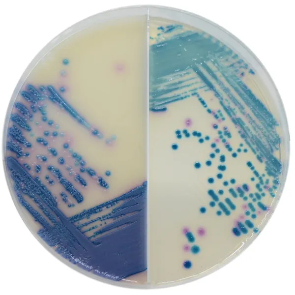 CHROMagar™ Mastitis