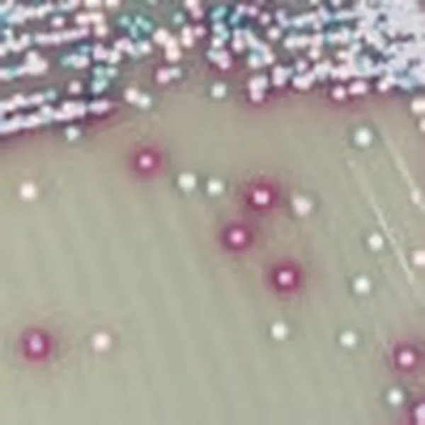 CHROMagar™ Malassezia