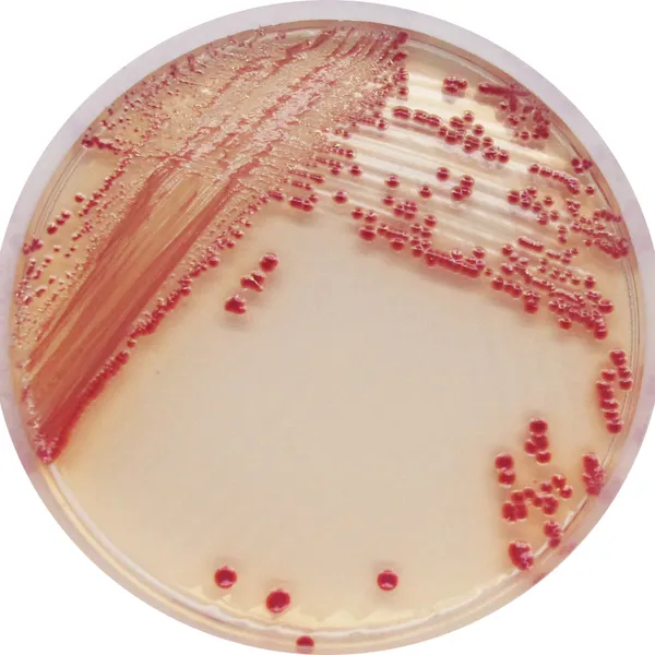 CHROMagar™ Acinetobacter