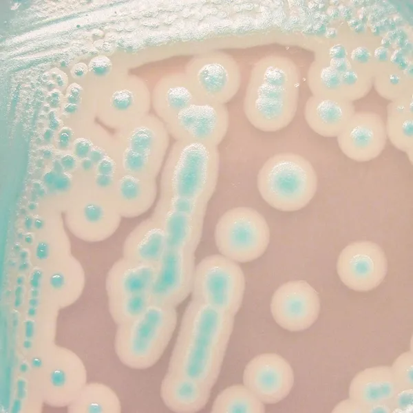 CHROMagar™ B. cereus