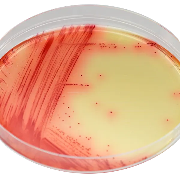 CHROMagar™ Mycoplasma