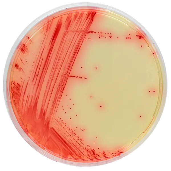 CHROMagar™ Mycoplasma