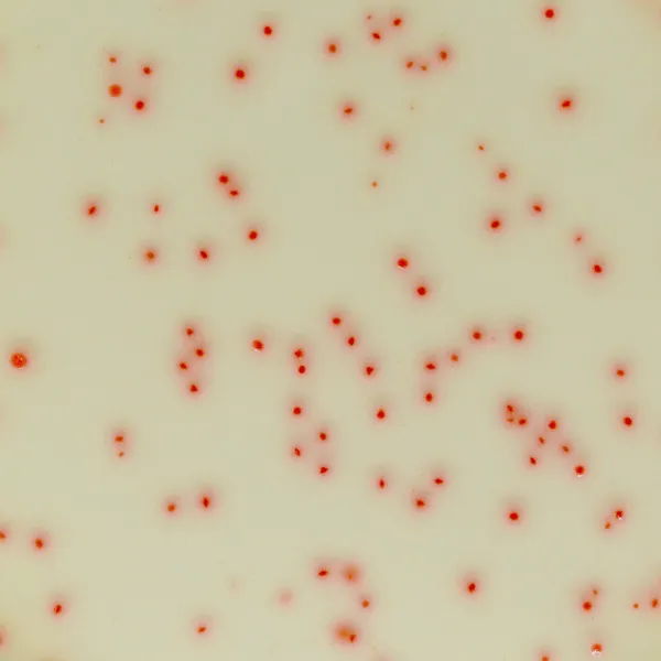 CHROMagar™ C. perfringens