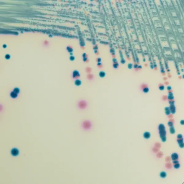 CHROMagar™ mSuperCARBA™