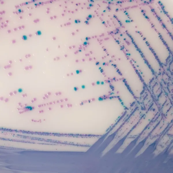 CHROMagar™ Salmonella Plus