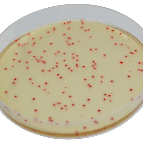 CHROMagar™ C. perfringens